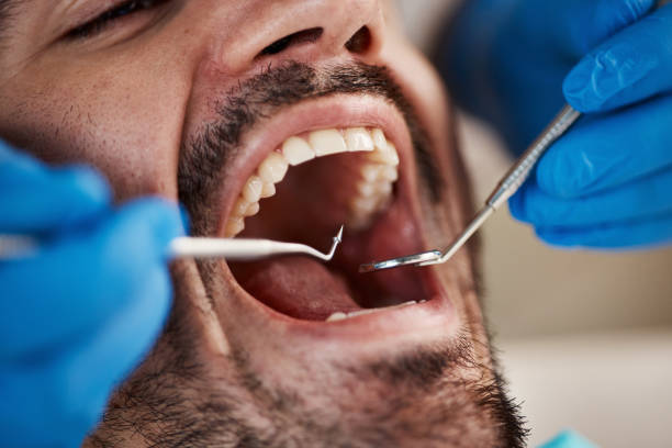 Tooth Infection Emergency Dentist in GA