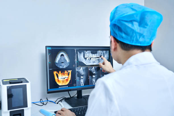 Best Dentist for Tooth Abscess  in Eastman, GA